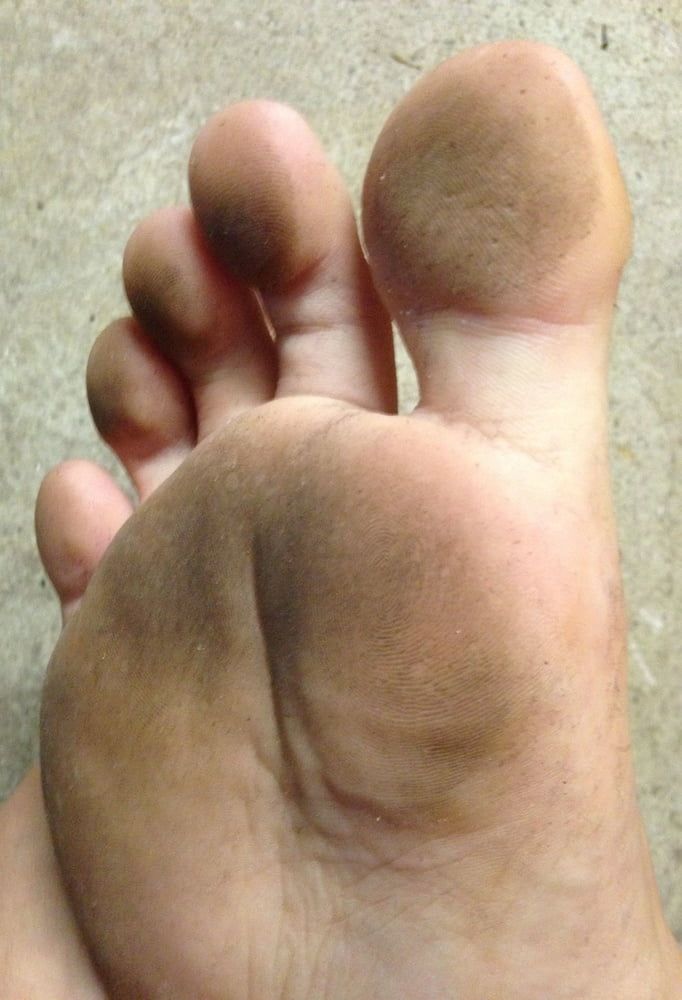 My Dirty Feet