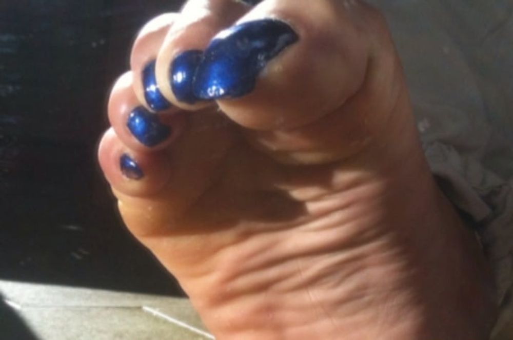 Blue toenails under sun ray