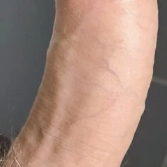 Dick 