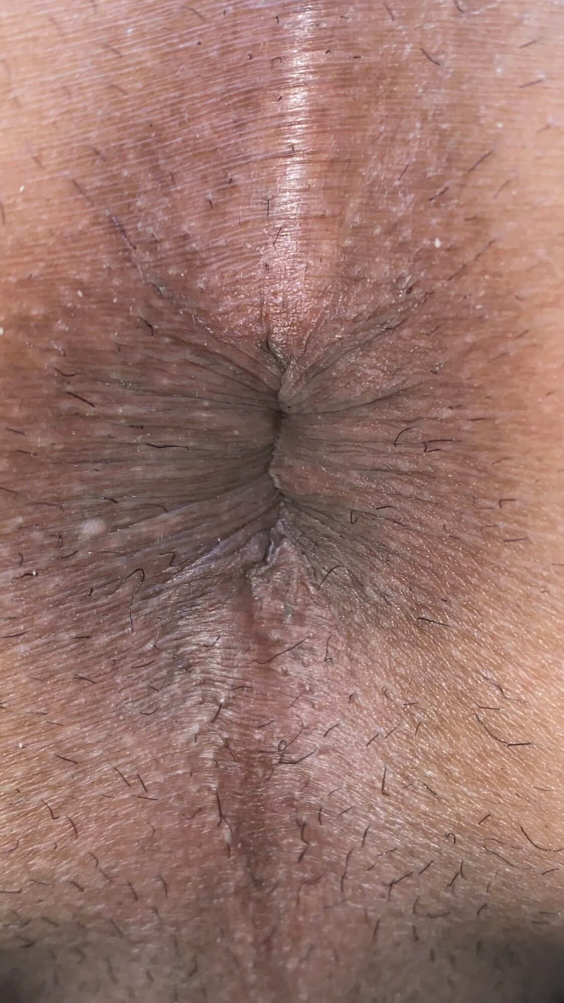 Close-up of a man's anus #11
