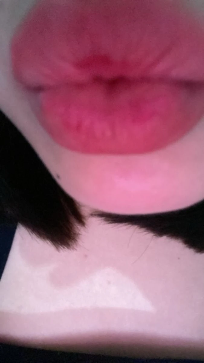 Kisses 💋 