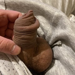 拡張包皮