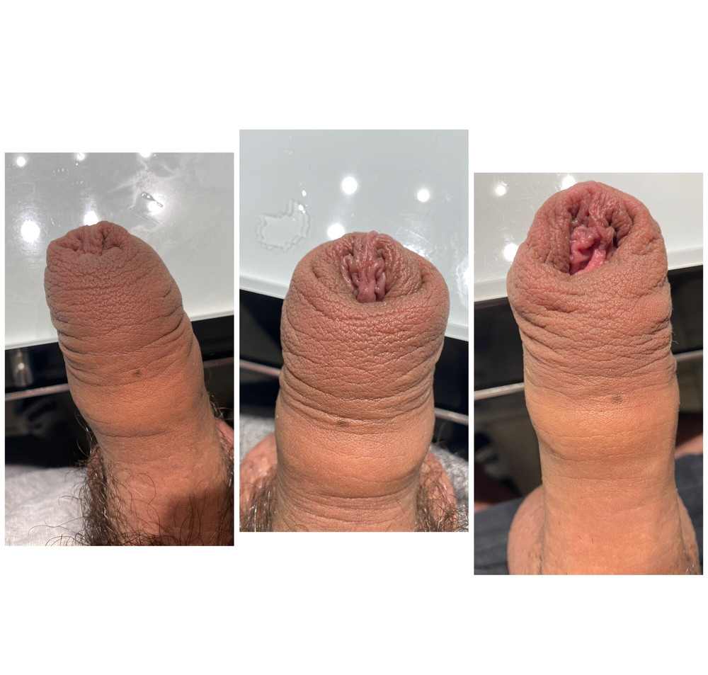 Foreskin stretching #2