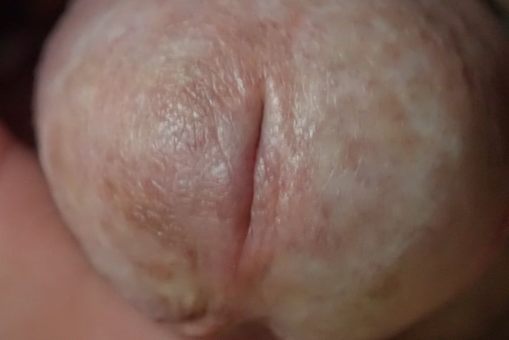 close up penis #4
