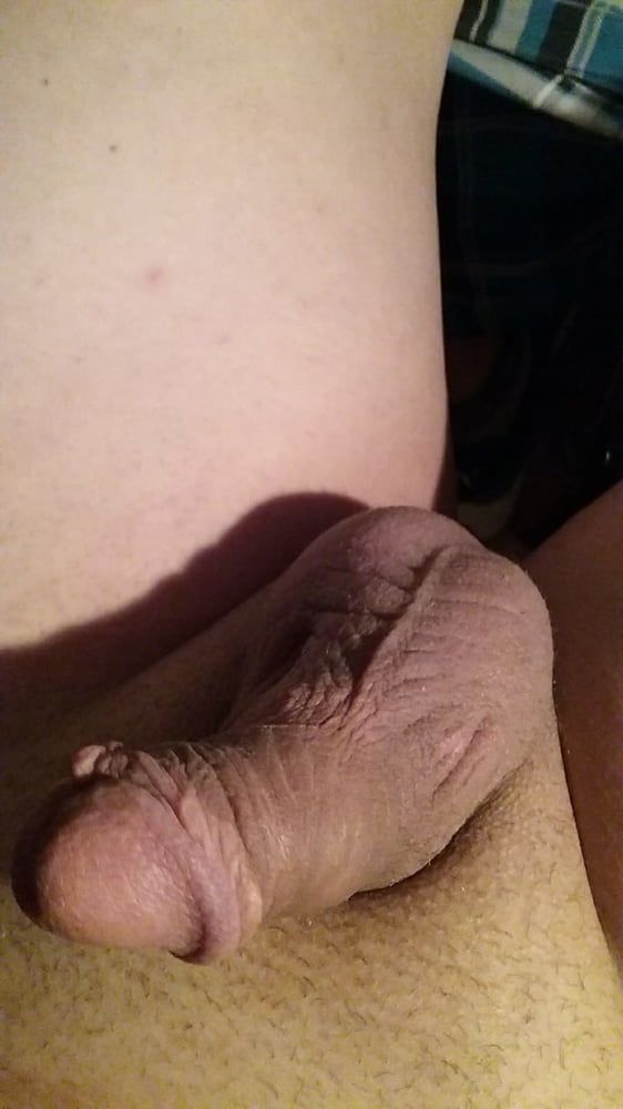 My circumcised penis new pics
