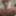 Face and Chest