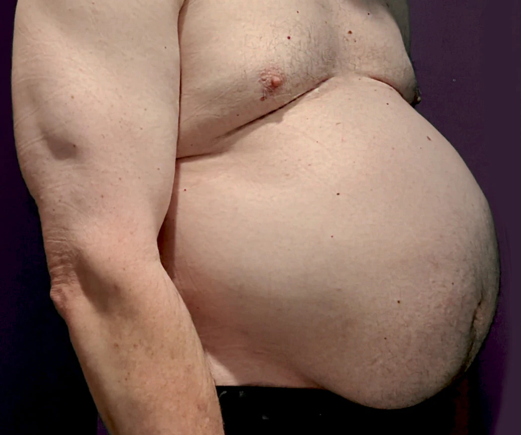Ximd9000 Big Bloated Belly