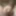 Micro penis, photos