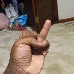 Pics of my Hands