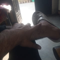 My leg photo