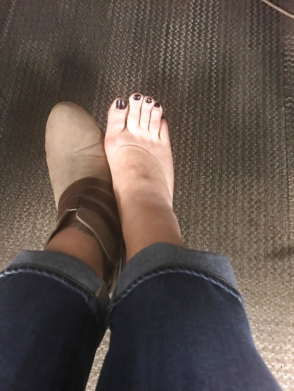 Fat flat feet #2