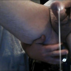 Prostate milking