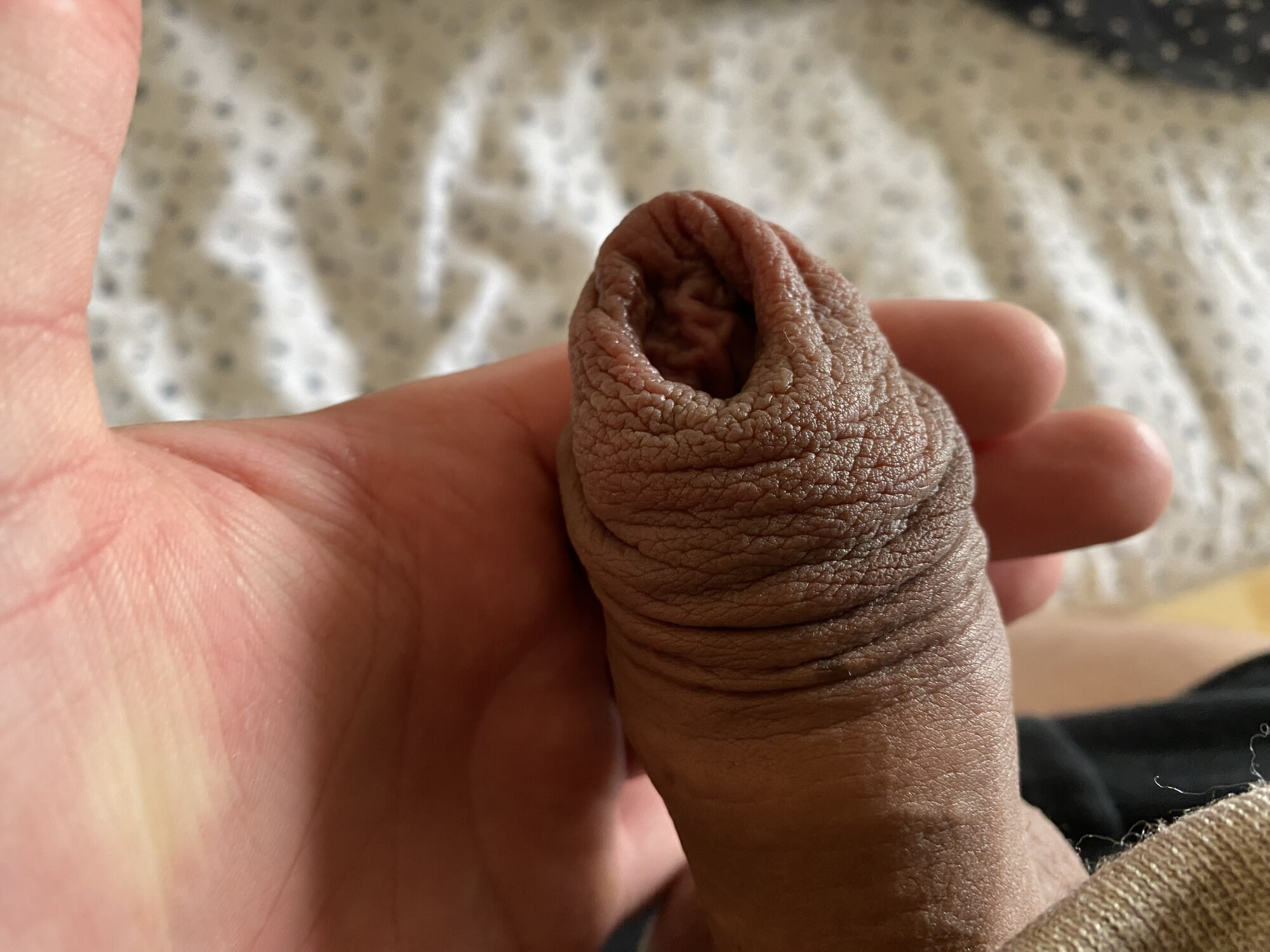 Pumped foreskin porn