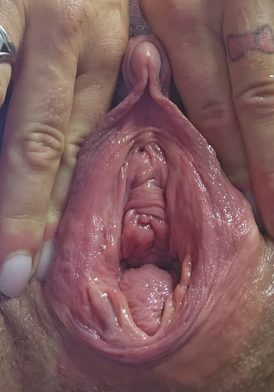 Closeup of my squirting prolapse pussy and a fucked urethral #4