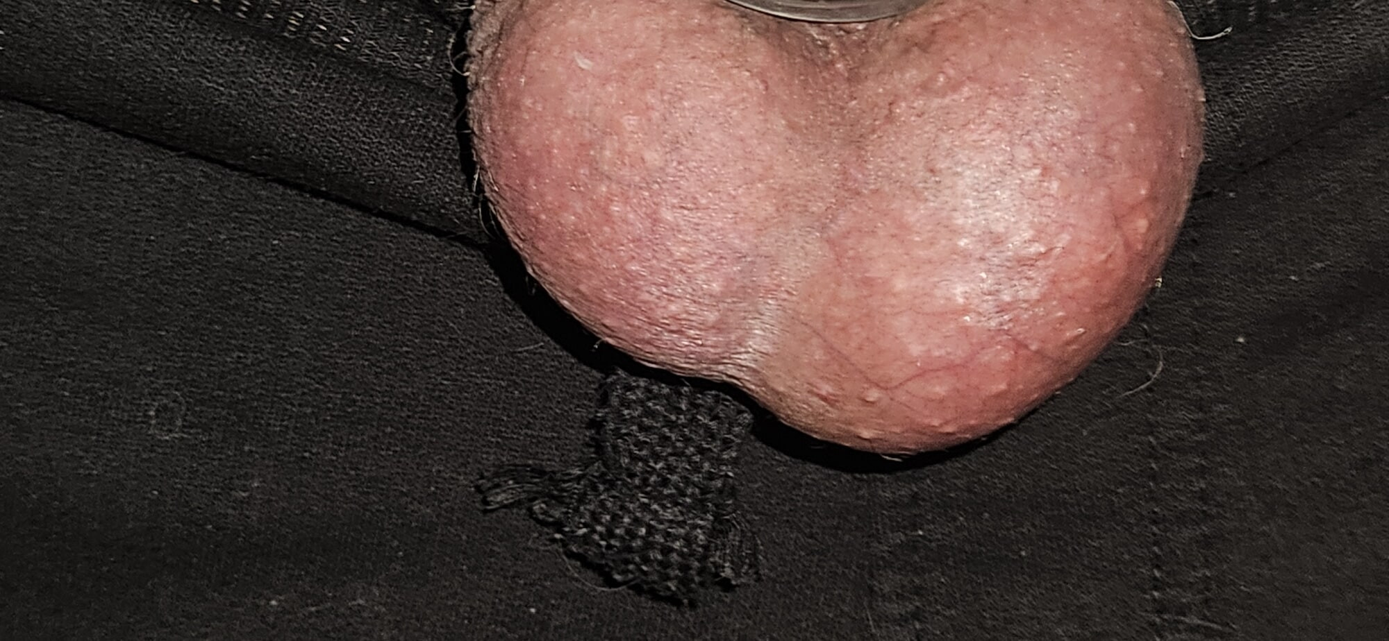 XXXX #5