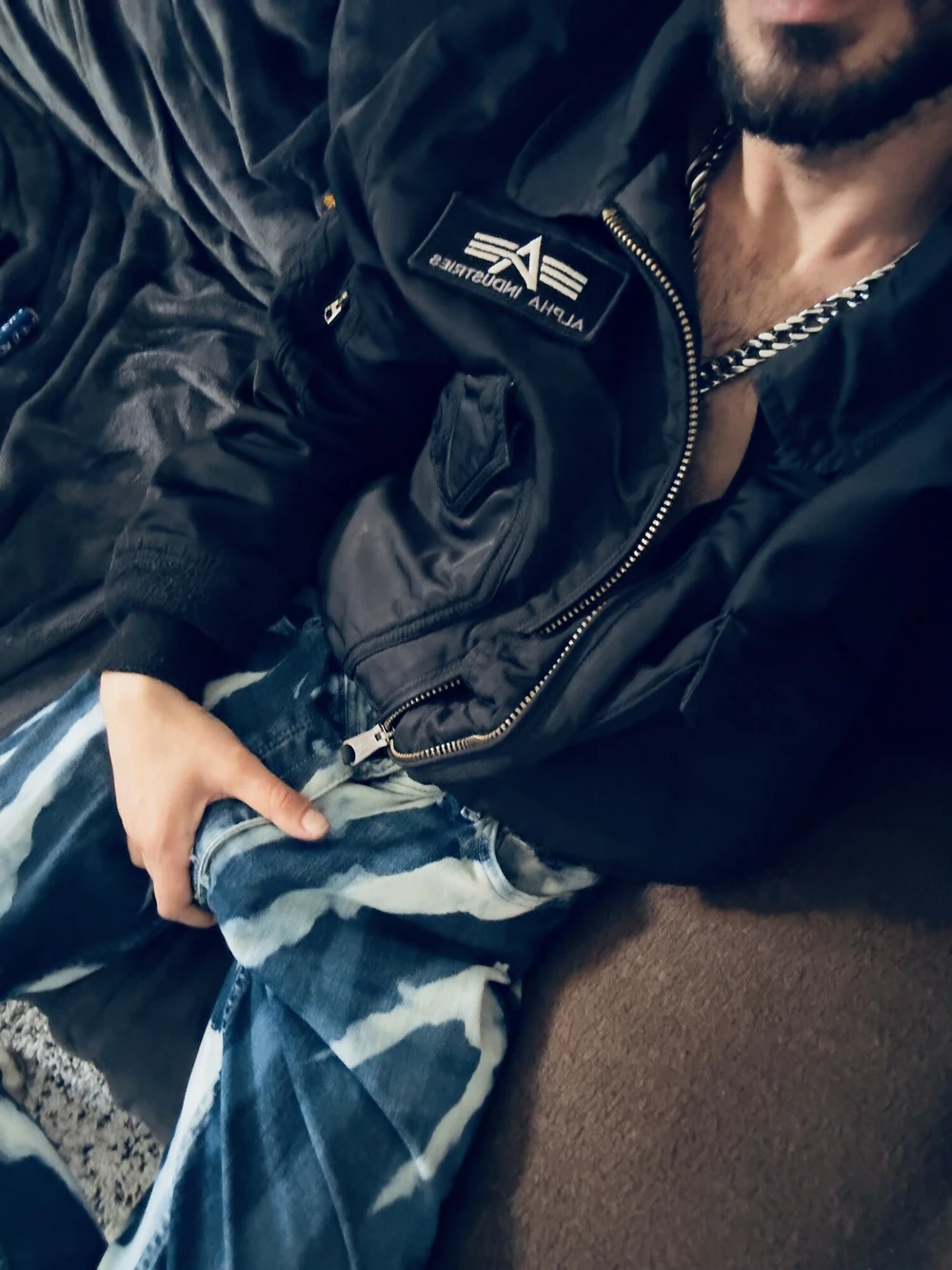 Bulging 