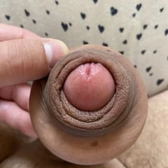 Foreskin extreme bondage
