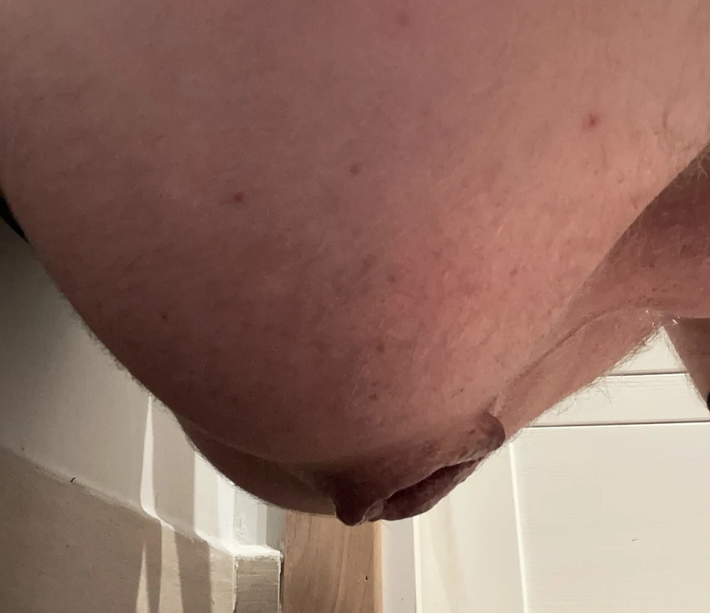 Odbyt #4