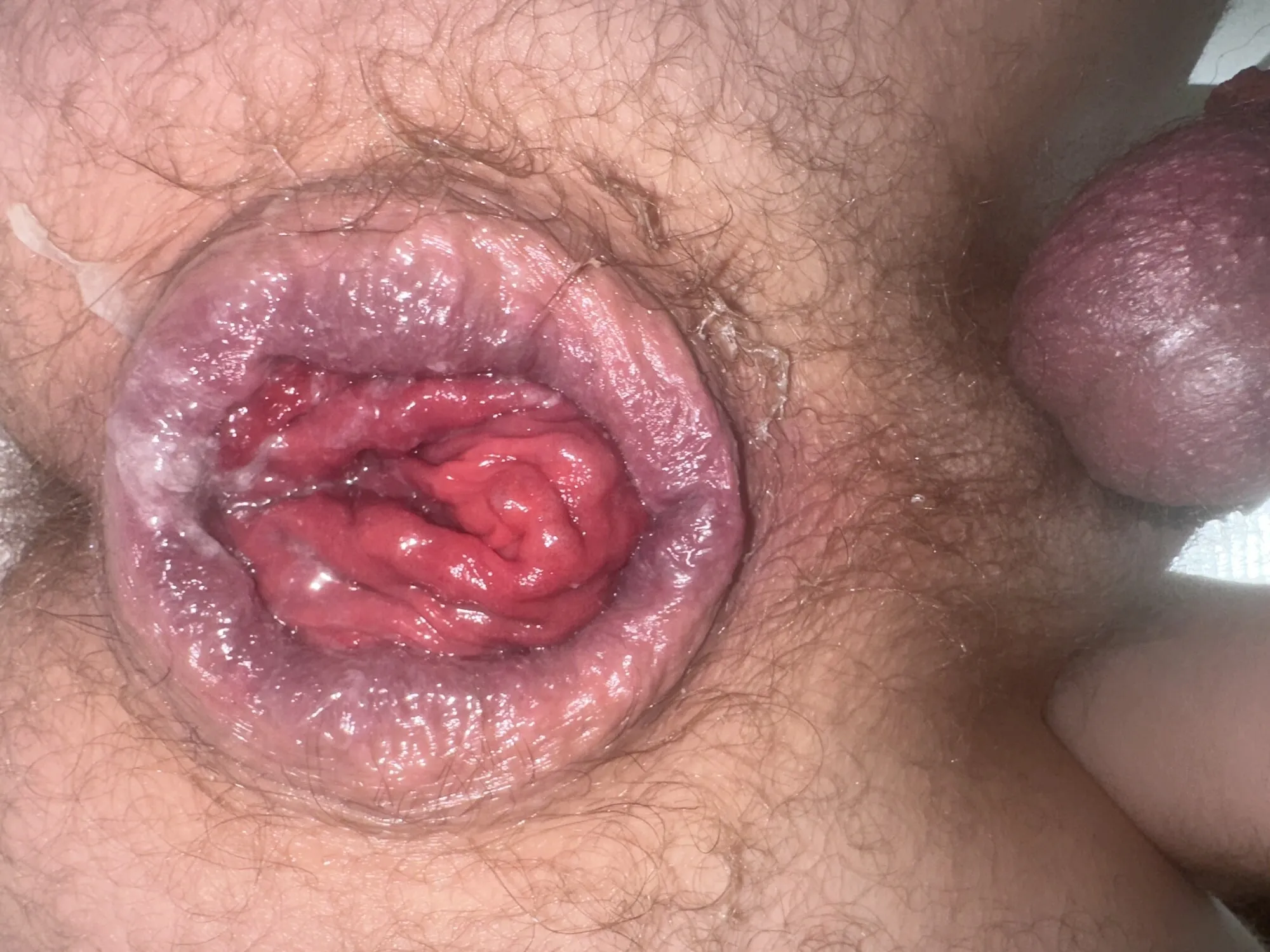 Anal prolapse in oxball ff pighole