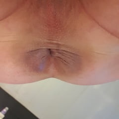 ANAL 