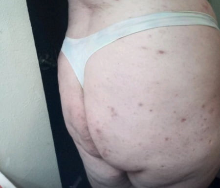 Whitechub