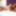 BLACK-TGIRLS: Ana Andrews Puts Her Best Feet Forward #2