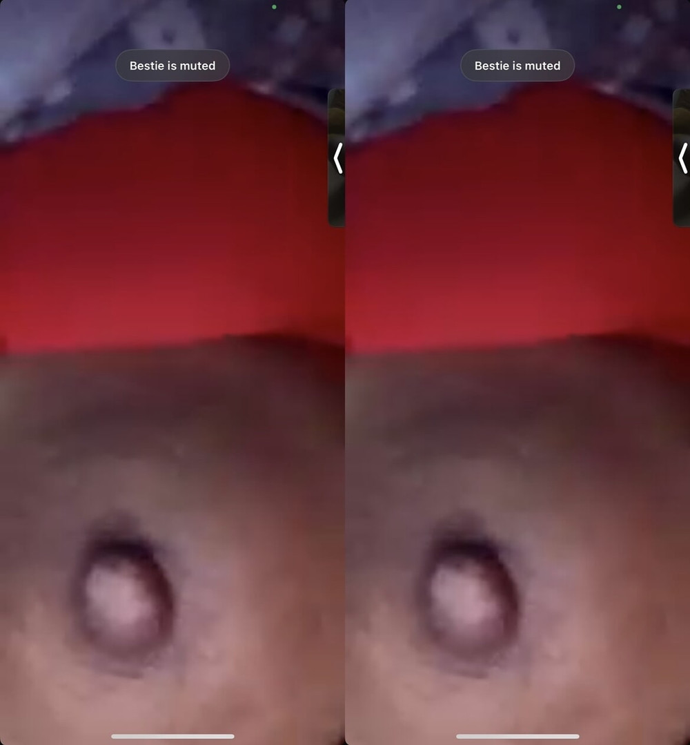 My nipple