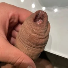 Foreskin after extreme stretching porn