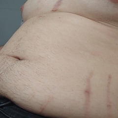 My belly and my chest