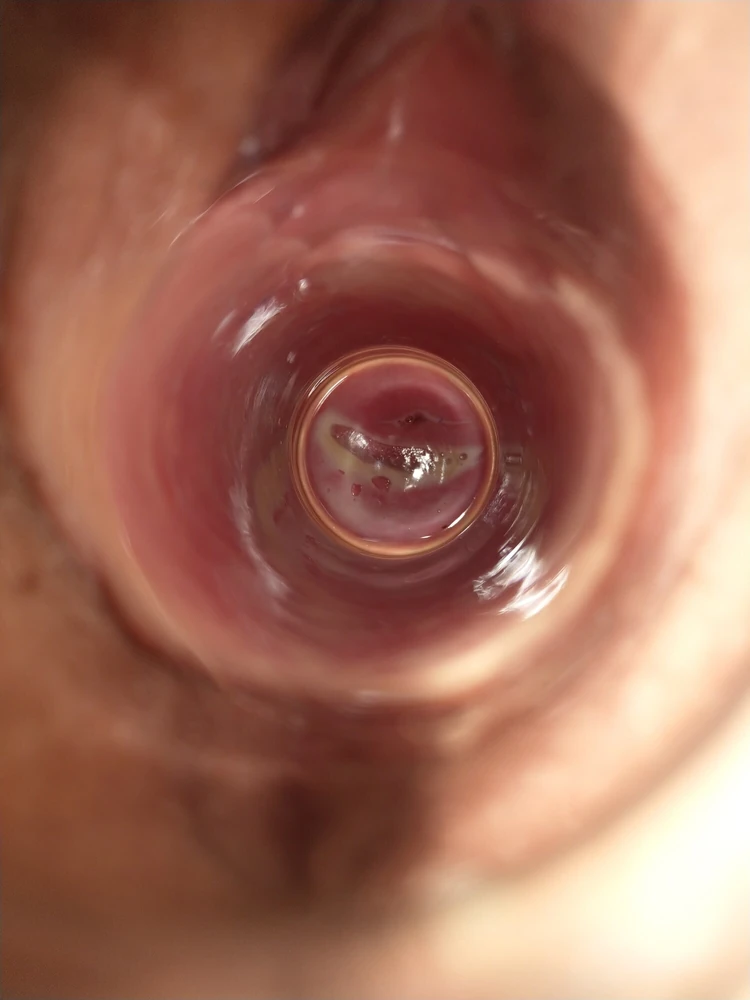 Cervix watched through glass tube in pussy #2