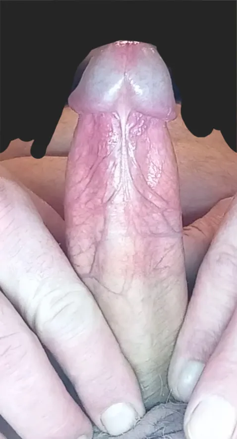 My penis #6