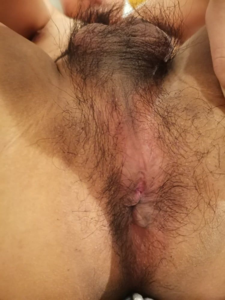 My hairy butthole #2
