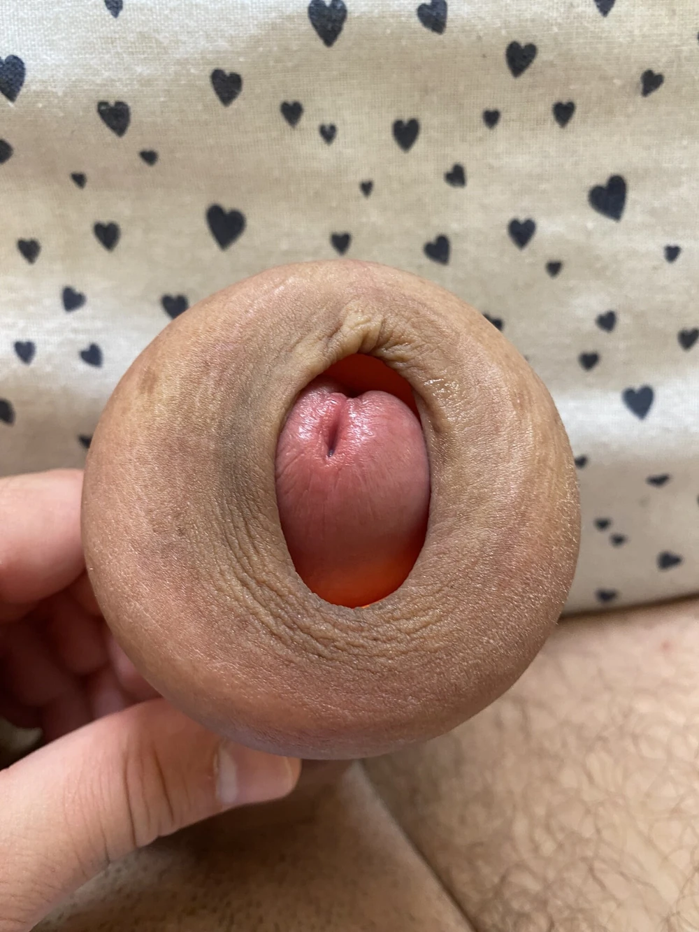 Extreme foreskin stretching #2