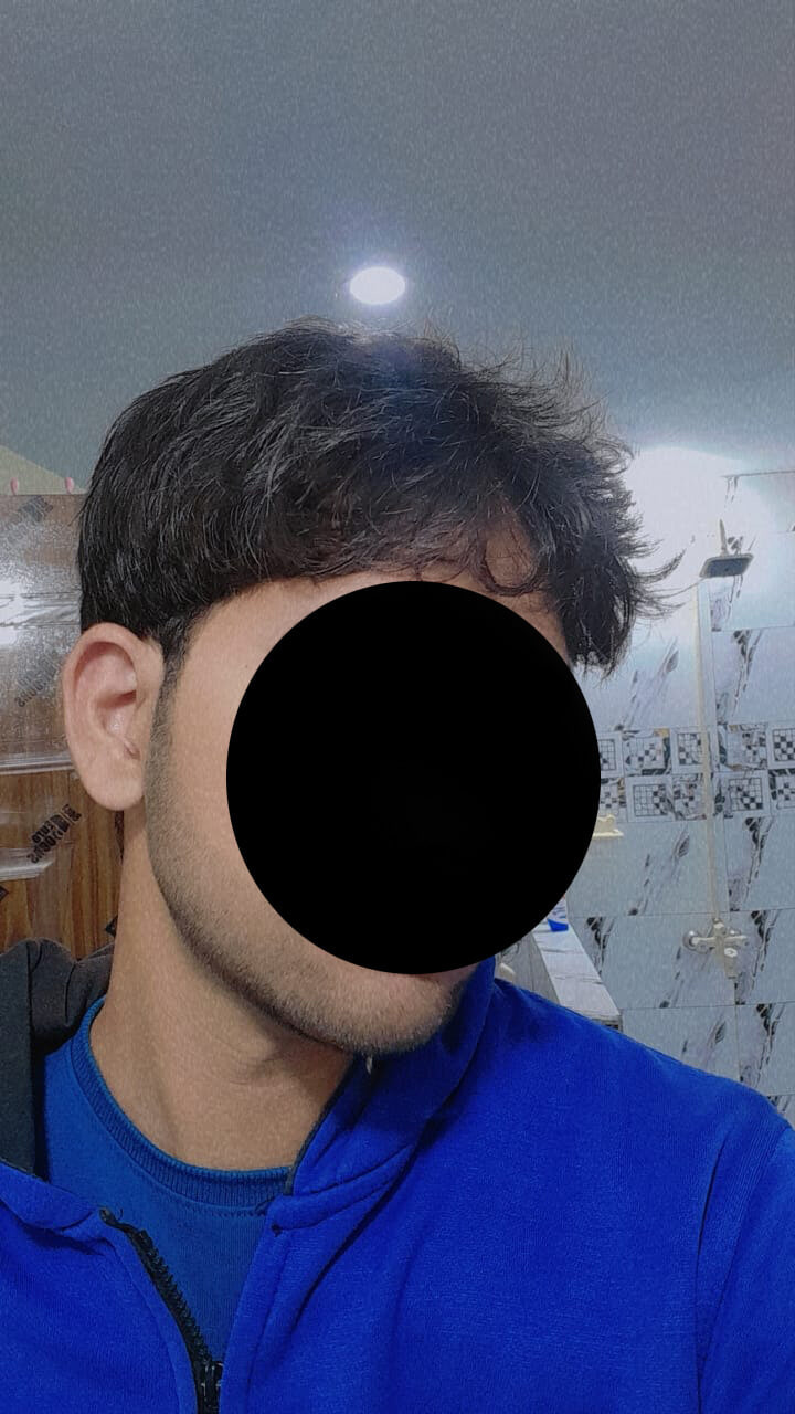 Me face blur #2