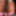 Extream Black Vulva Closeup Of Sheisnovember Black Vagina #7