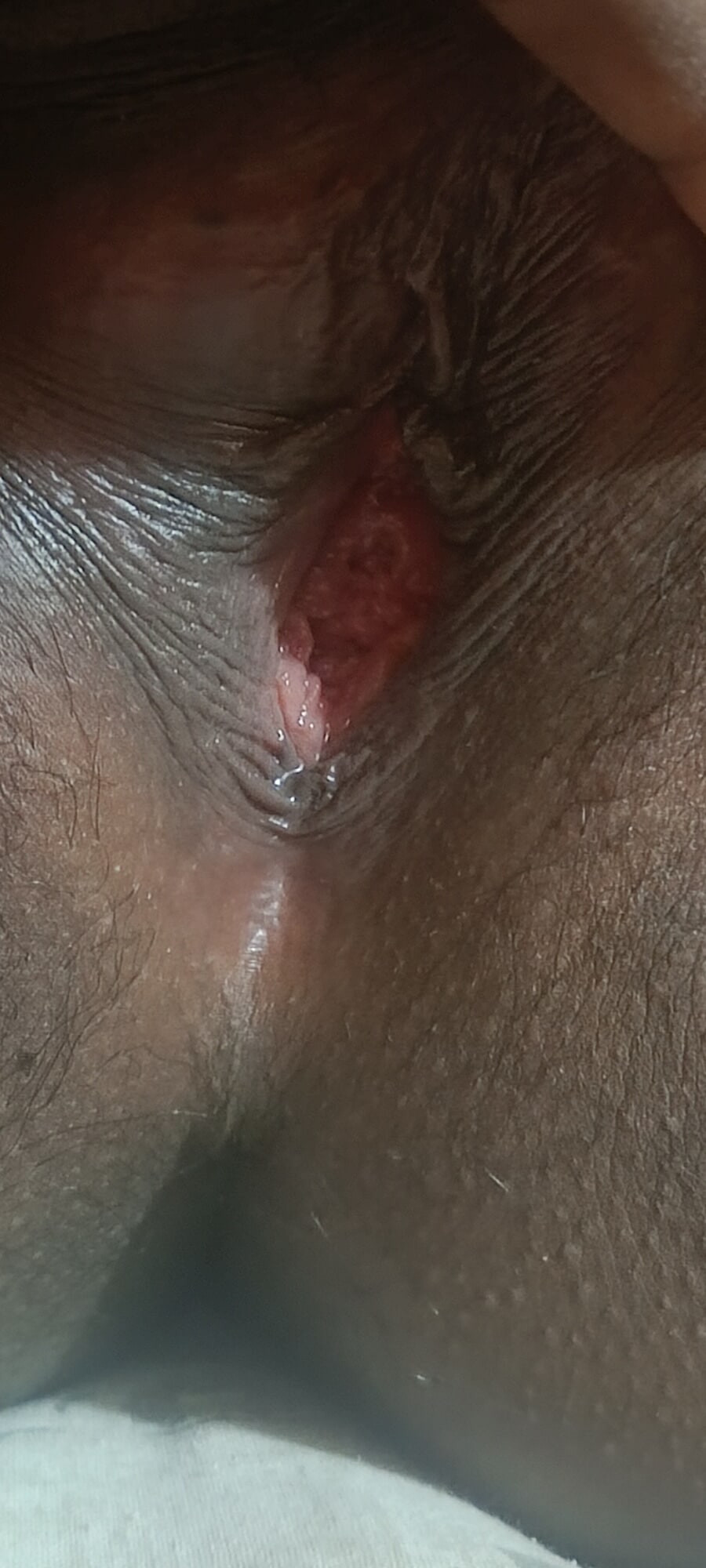 My vagina #2