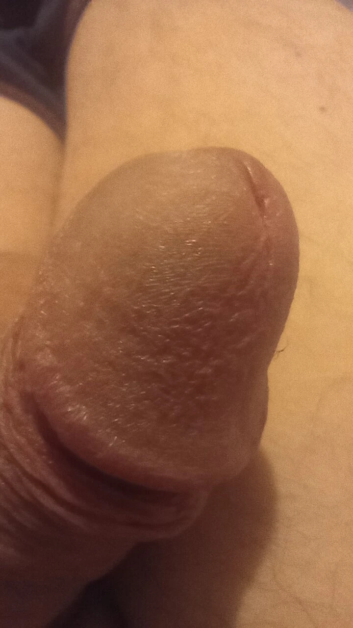 Close up