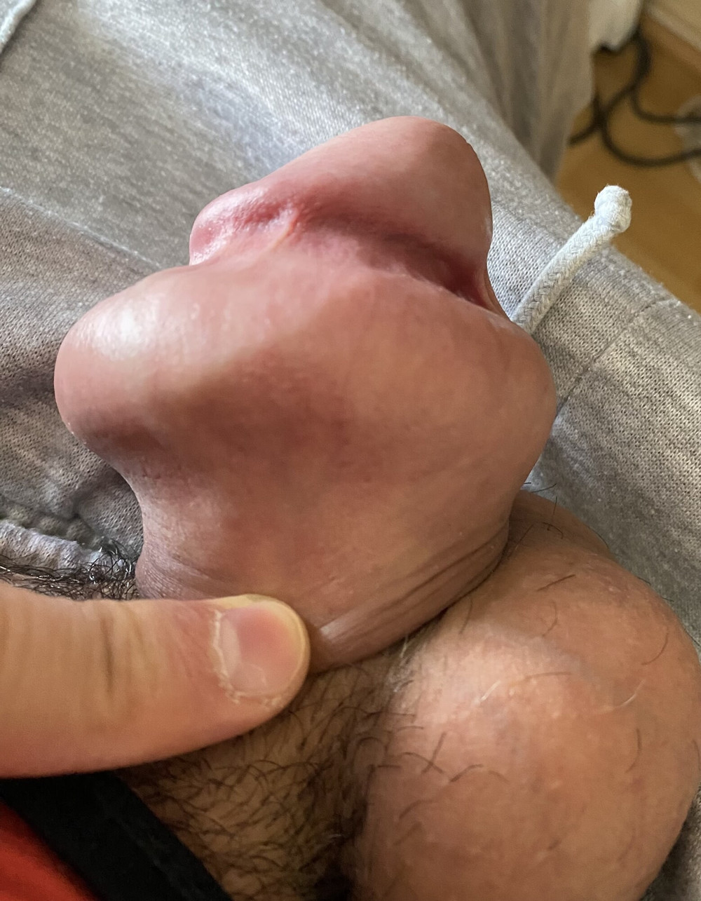Foreskin extreme stretching porn #4