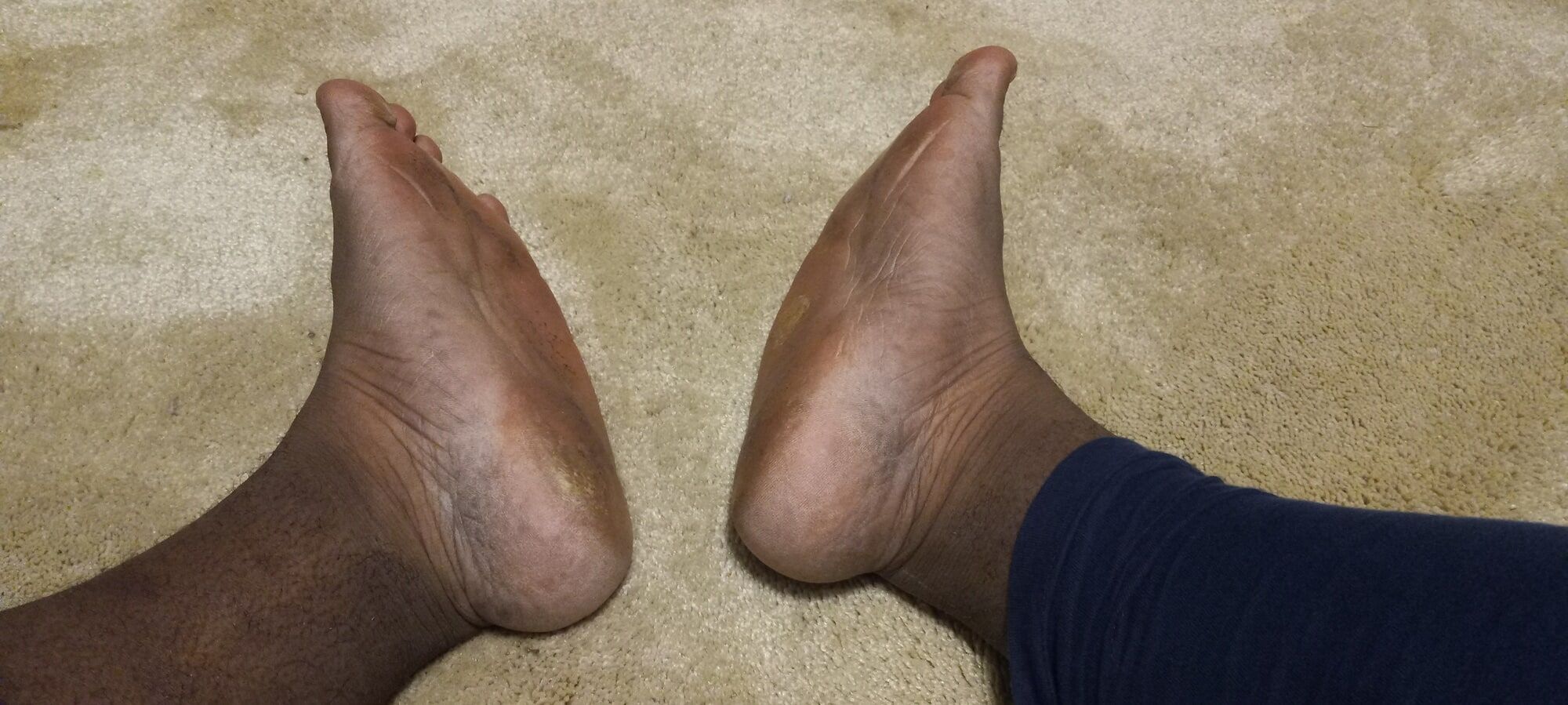 Pics of my Feet #14