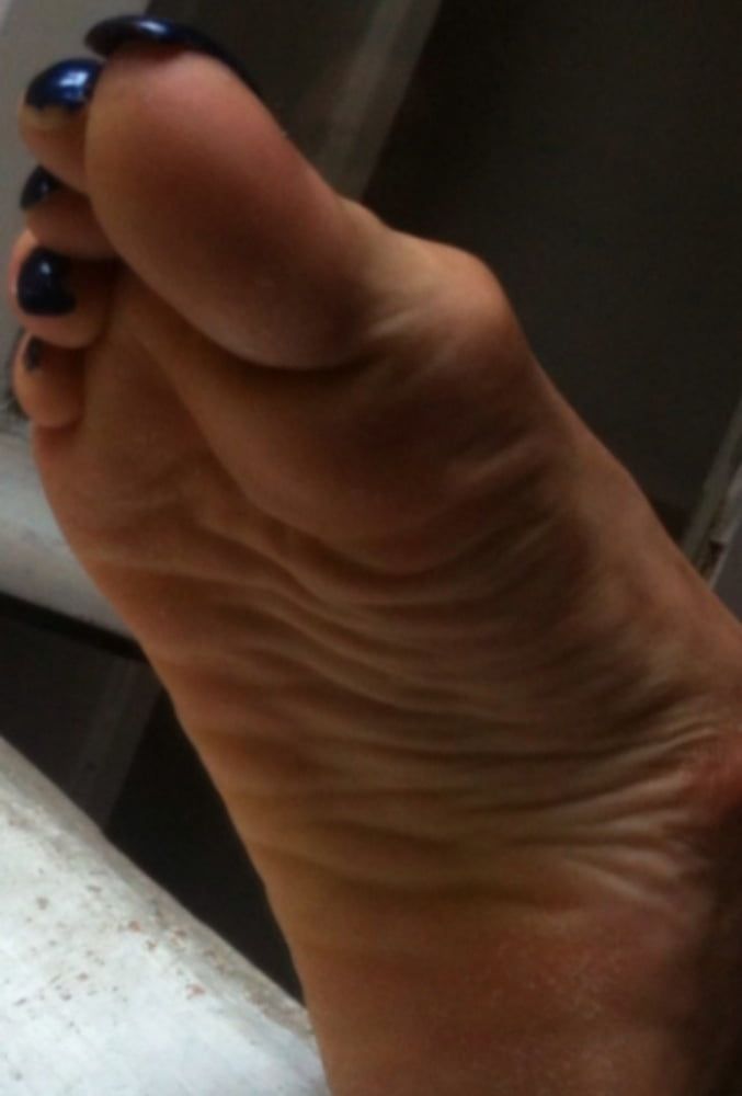 blue toenails and soles feet after day at beach  #5