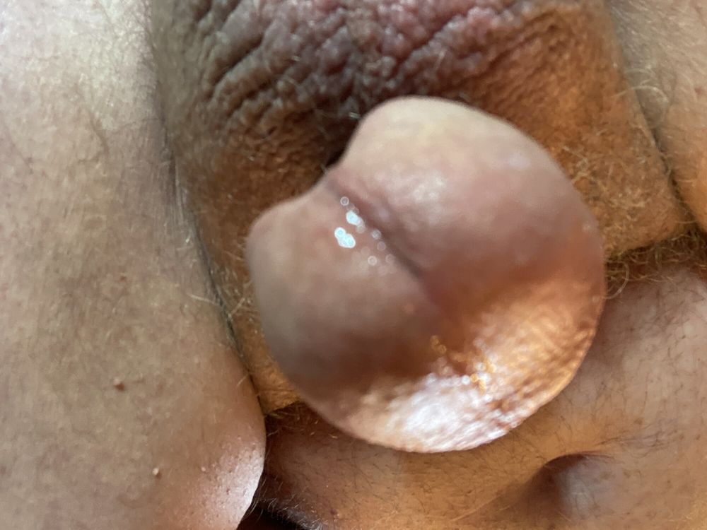 More hypo cock pics #22