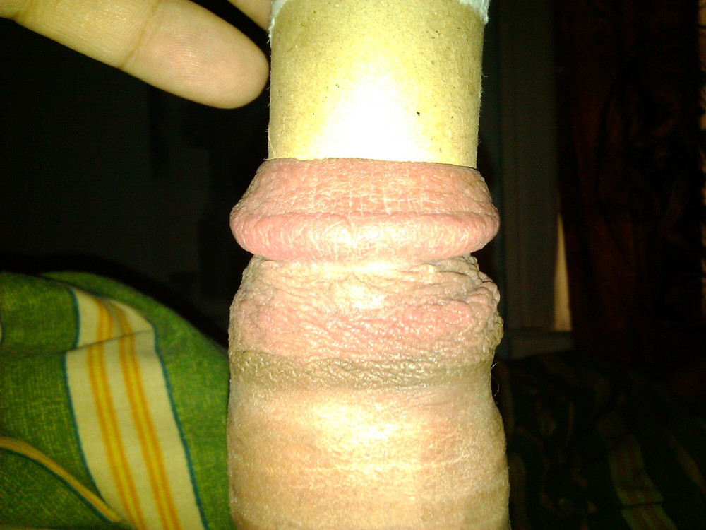 More Dick #32