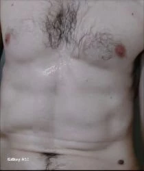Breast