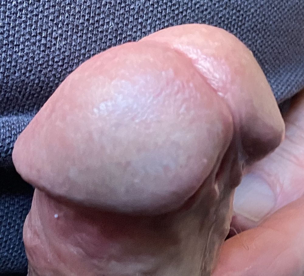 hypospadias cock #28