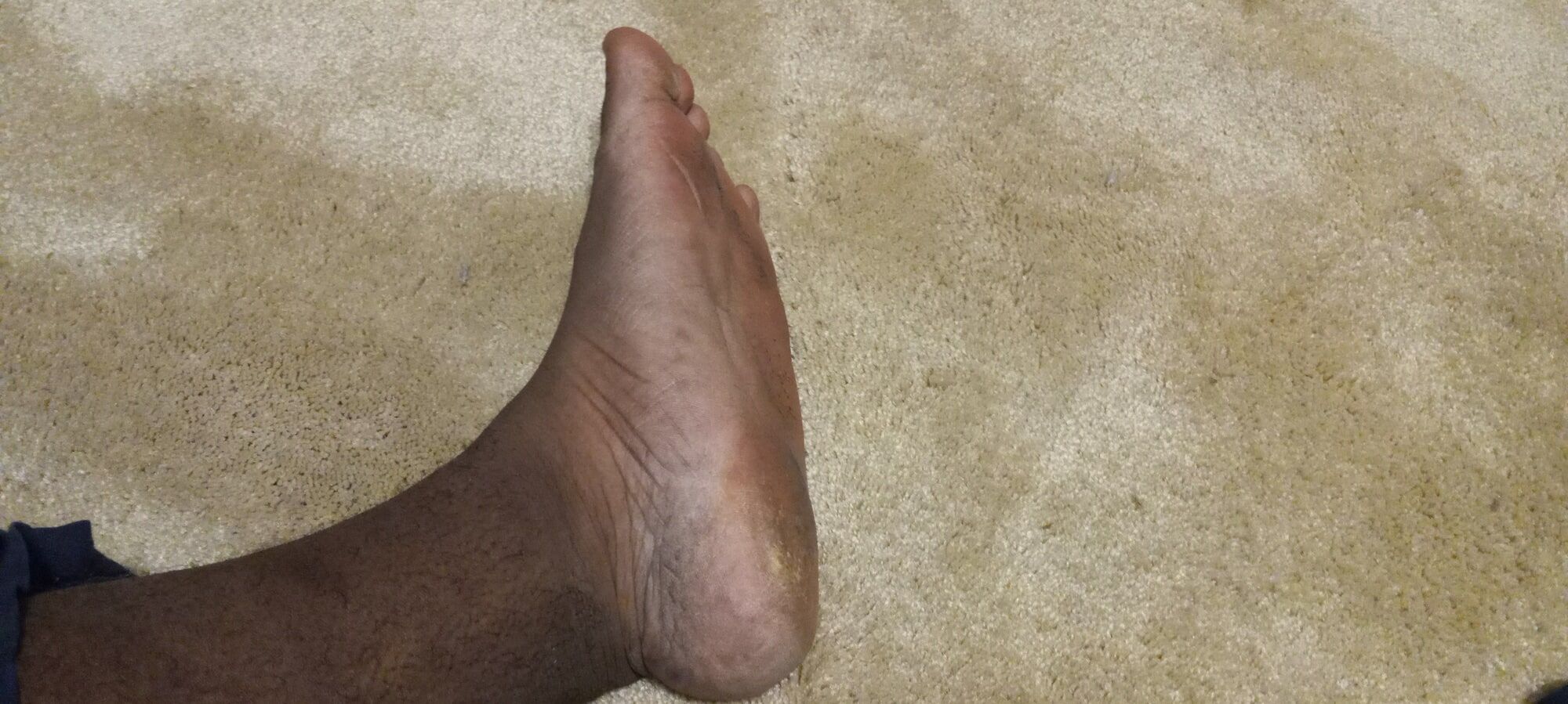 Pics of my Feet #12