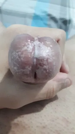 Wet Glans Penis