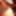 Giant gaping asshole 3 7cm gapes spread assfist butt 01.2011 #8