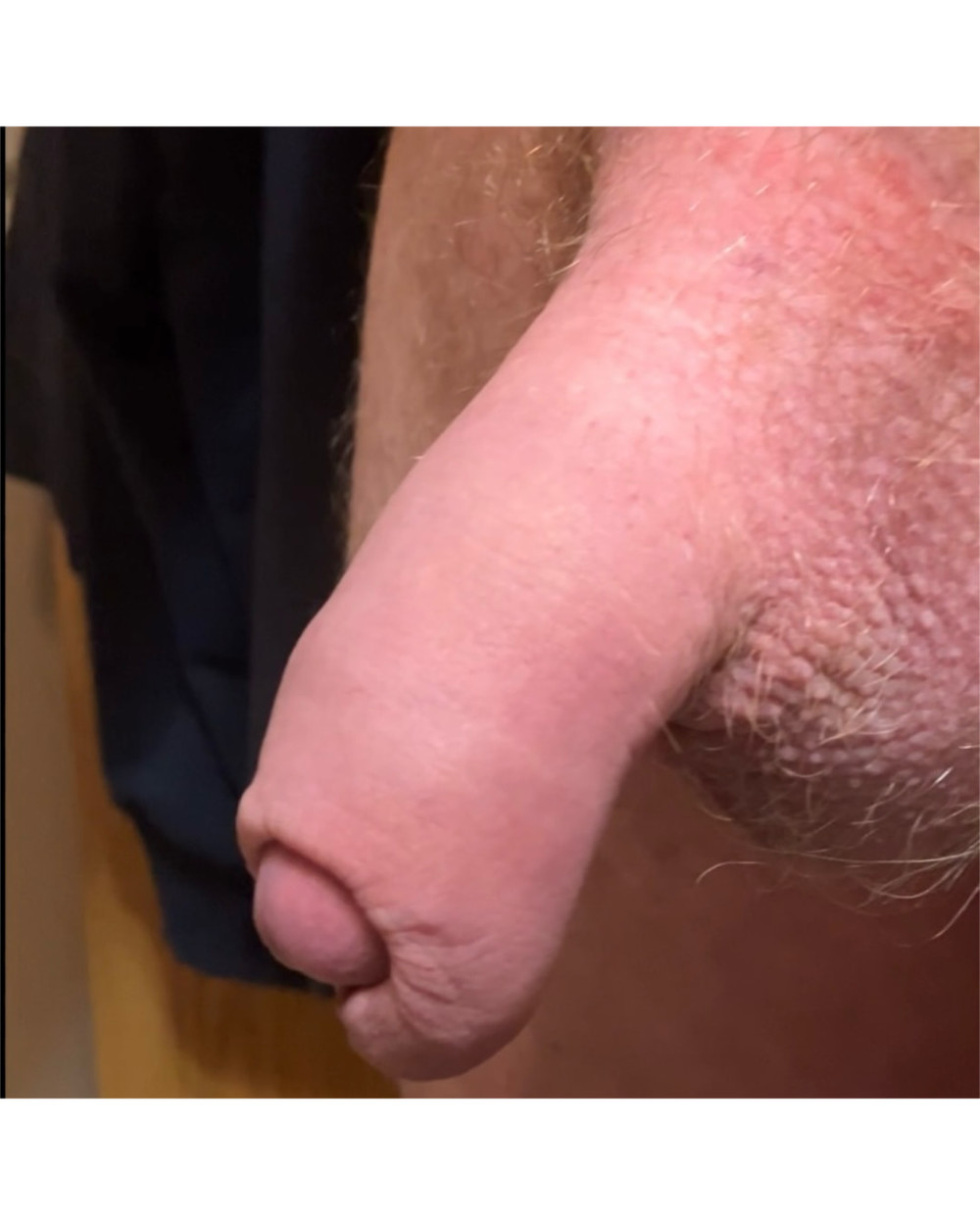 Compilation of uncut cock pics #32
