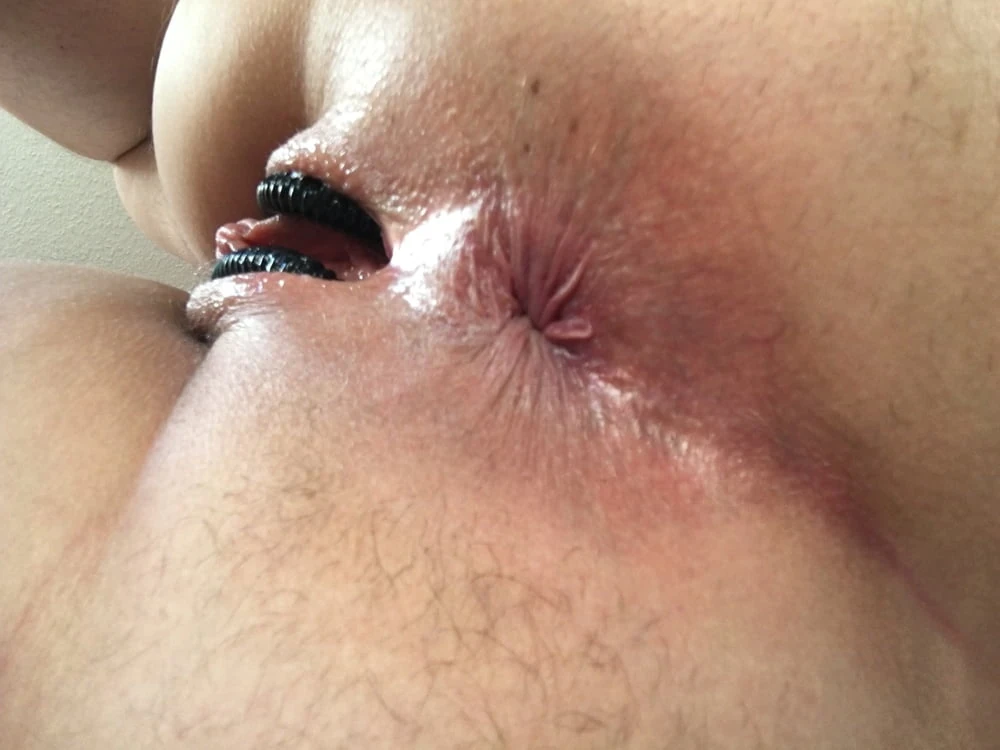 Schamlippenspreizer #24