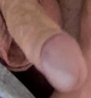 Penis
